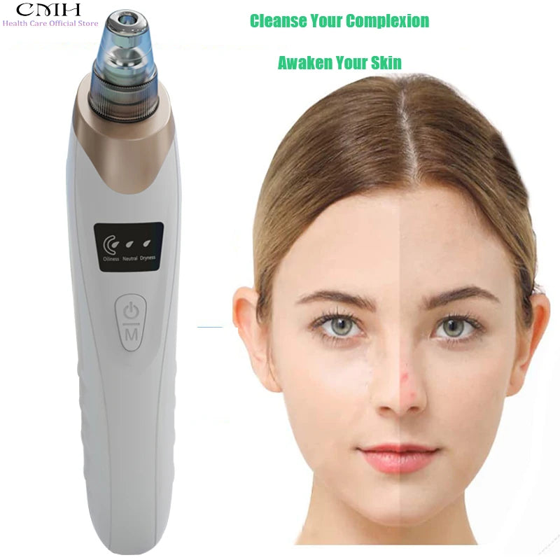 CMH Blackhead Remover Vacuum Pore Cleane