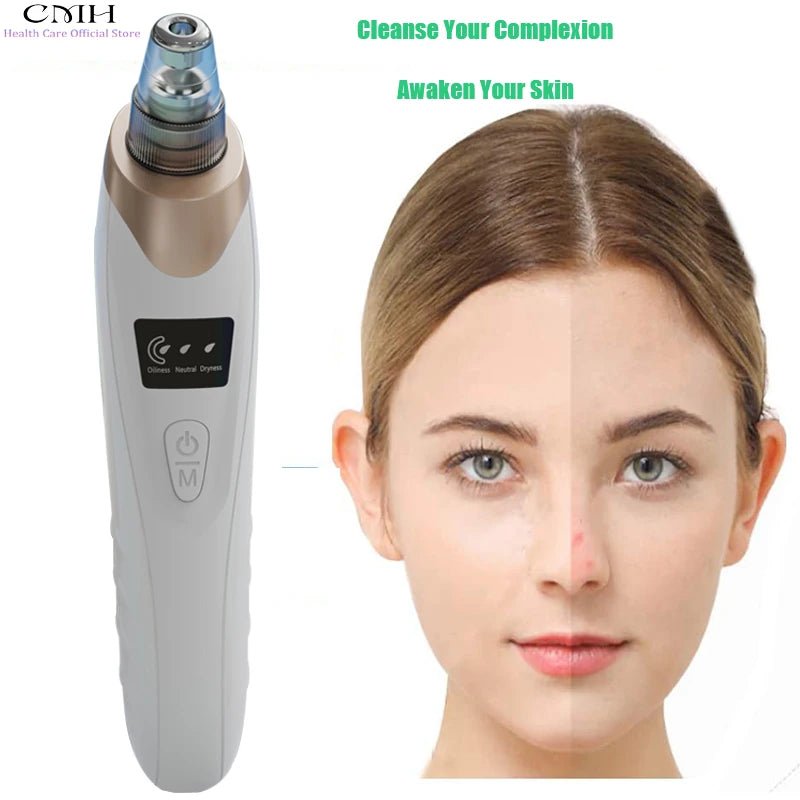 CMH Blackhead Remover Vacuum Pore Cleane - Everyday Pocket Glow